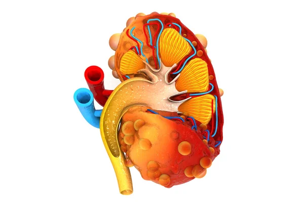 Nierenerkrankungen Nierenquerschnitt Illustration — Stockfoto