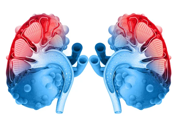 Болезнь Почек Поперечное Сечение Почек Иллюстрация — стоковое фото