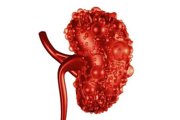 腎臓病だ 腎臓の断面図 3Dイラスト — ストック写真