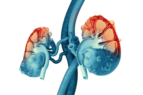 Doença Renal Secção Transversal Rim Ilustração Fotografias De Stock Royalty-Free