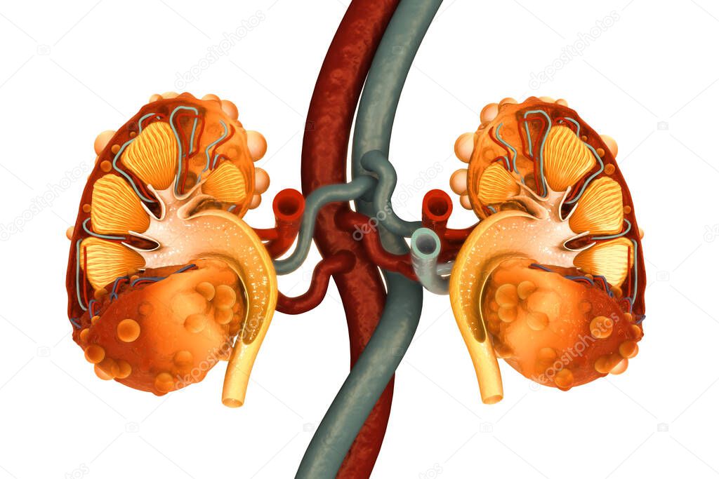 Kidney disease. Kidney cross section. 3d illustration