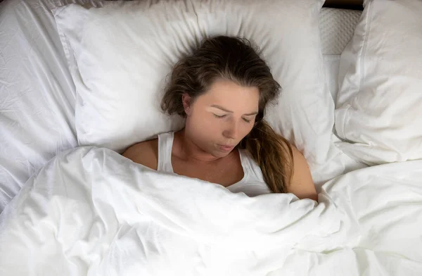 Chica Joven Con Pecas Durmiendo Con Sábanas Blancas Vista Superior — Foto de Stock