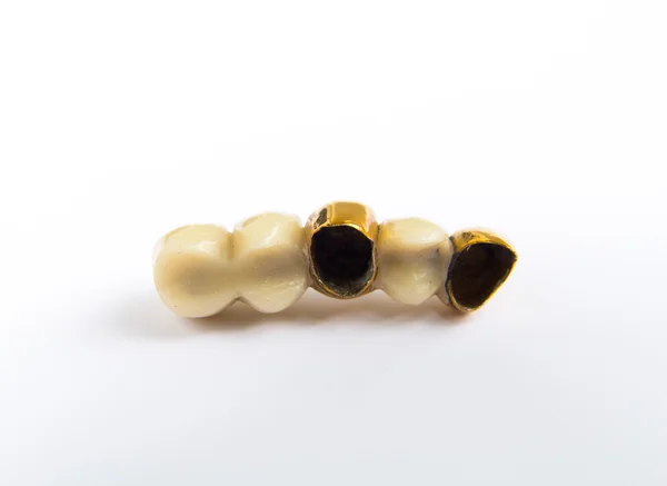 Зубная керамика и золотые зубные коронки на белом фоне. Isolated . — стоковое фото