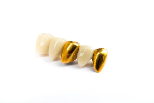 Coronas dentales de cerámica y dientes de oro sobre fondo blanco. Aislado . — Foto de Stock