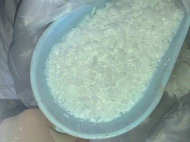 nedensel soda taneleri tehlikeli kimyasallar.