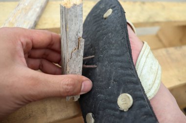 Keskin raptiye ayağımı yaraladı.