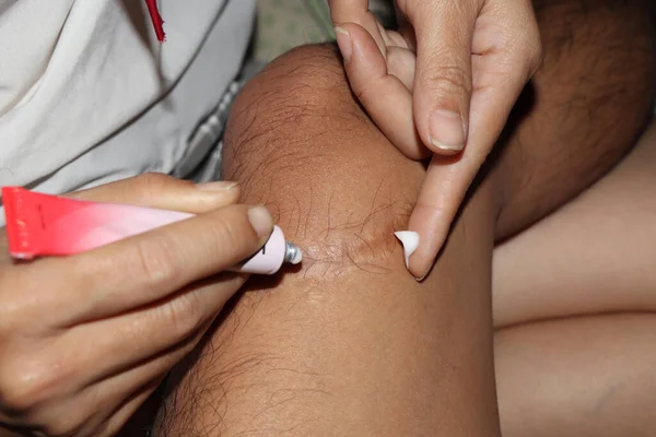 Yara izini merhemle tedavi et.