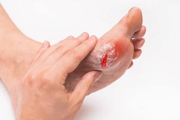 A doctor\'s hand touches and examines the wound on the foot of an elderly woman on a white background.