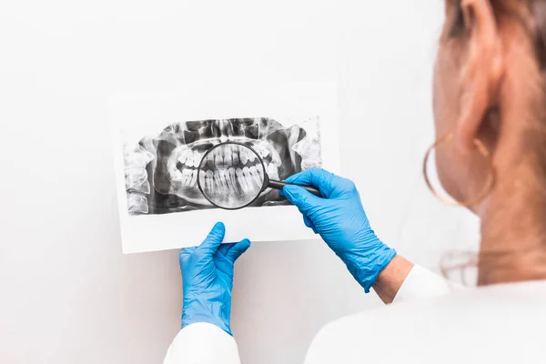 Koruyucu tıp eldivenleri giymiş bir kadın doktor ellerinde dişlerinin röntgenini tutuyor ve beyaz bir arka plandaki büyüteçle inceliyor..