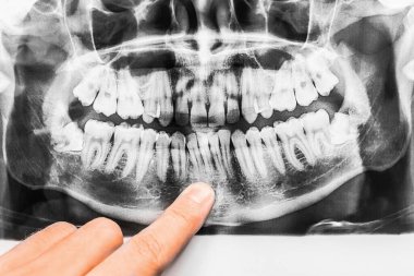 Diş hekiminin eli ağzın tıbbi görüntüsünü işaret eder ve dişlerin hafif kıvrımını yakından inceler..