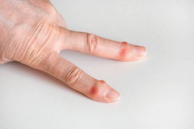 Beyaz arka planda yaşlı bir adamın hasta kadın parmakları..