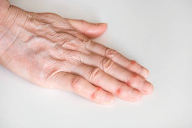 Beyaz arka planda yaşlı bir adamın hasta kadın parmakları..