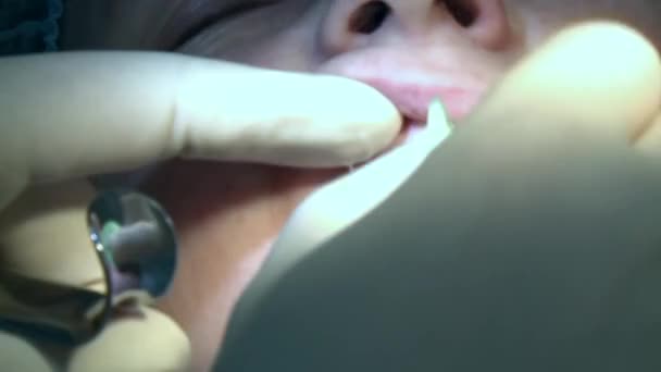 Il medico professionista rimuove il sangue di un paziente nella moderna sala operatoria dello studio utilizza moderne attrezzature dentistiche e anestesia. Primi piani di chirurgia dentale orale e maxillo-facciale. — Video Stock