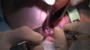 Dişçi, modern ofis kliniğindeki bir hastaya diş ipi ve anestezi uygular. Kapalı diş bakımı oral ve maksimum yüz implantı ameliyatı.