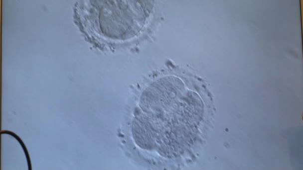 Cellulaire afdeling van een in vitro foetus onder Microscoop. Generieke cel verdelen. — Stockvideo