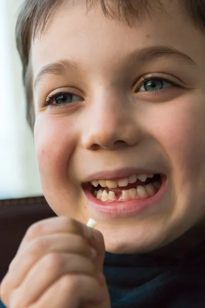 Young boy showing his first missing tooth — Stock Photo, Image