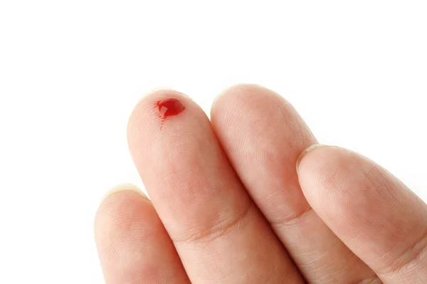 Bleeding from the cut finger — Stock Photo, Image