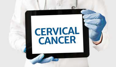 Doktor CERVICAL CANCER ile bir tablet tutuyor