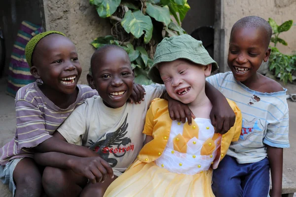 Albino child and boys in Ukerewe, Tanzania