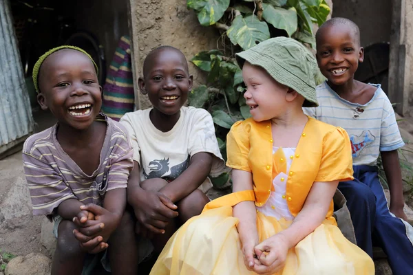 Albino child and boys in Ukerewe, Tanzania — Stockfoto