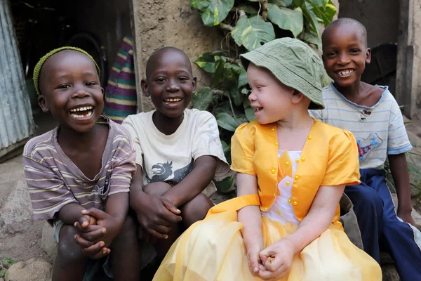 Albino child and boys in Ukerewe, Tanzania