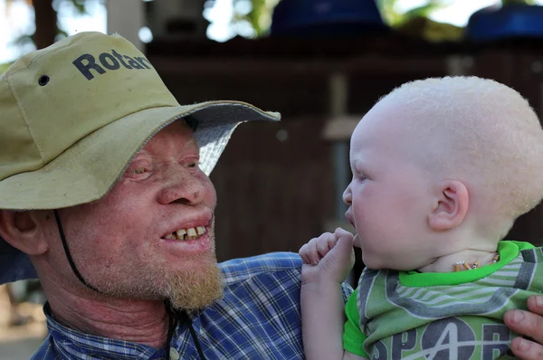 Ayah dan anak Albino di Ukerewe, Tanzania — Stok Foto