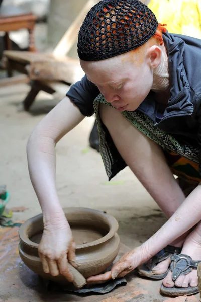 Wanita Albino di Ukerewe — Stok Foto