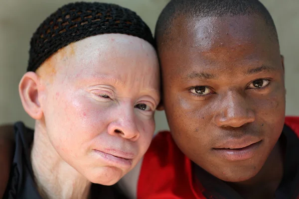 Ukerewe的Albino母亲和儿子, 免版税图库图片