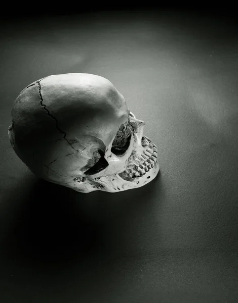 人类头骨的特写分析 — 图库照片