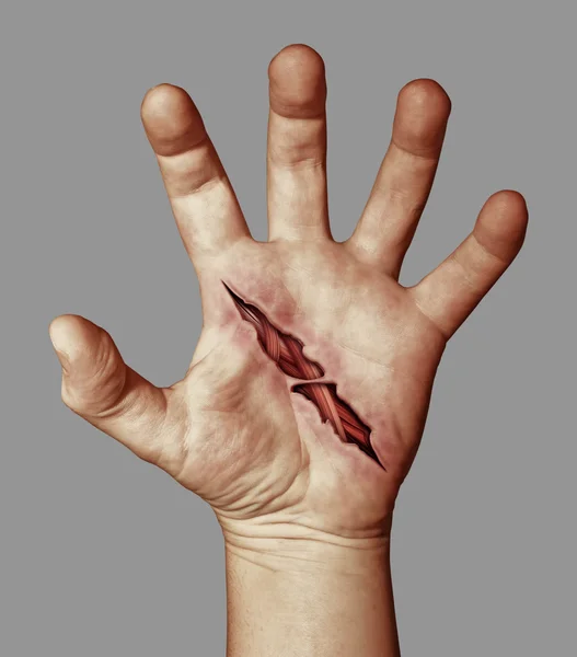 Πληγωμένο του χέρι — Φωτογραφία Αρχείου