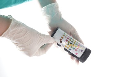 idrar testi çizgili bir hemşire tarafından muayene