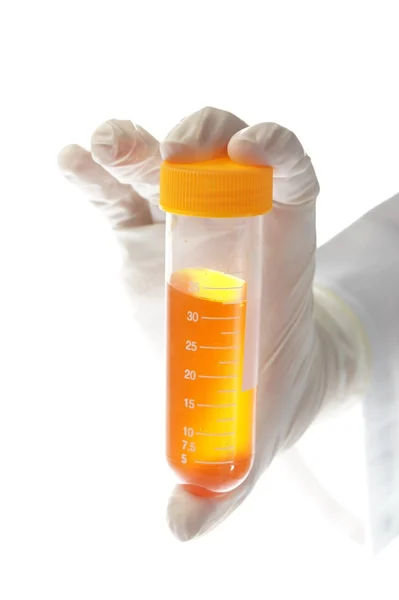 Hand holding liquid sample - urine — Stock Photo, Image