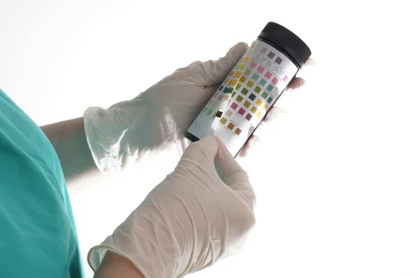 Test delle urine strisce esaminate da un'infermiera — Foto Stock