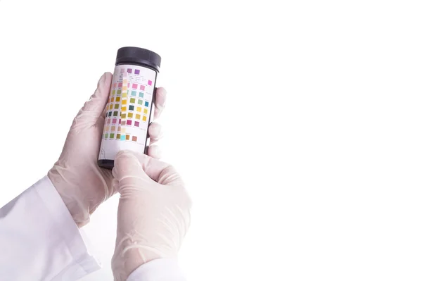 Urine test stripes examined by a nurse. Lab sample — Stock Photo, Image