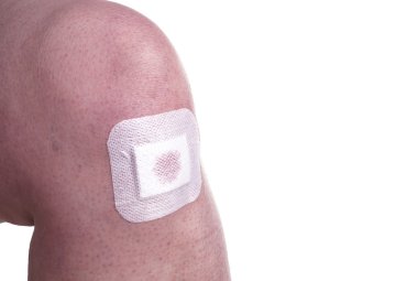 Alçı bir Womans diz üstü 