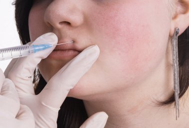 Genç Bayan botox, dolgu veya vitamin enjeksiyonu üst dudak alır. 