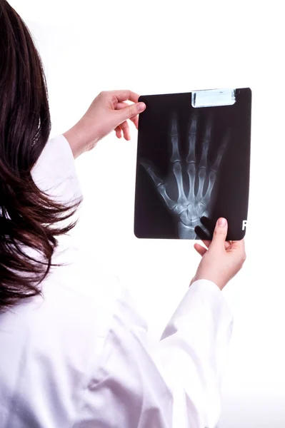 Doutor examinar raio X de mão — Fotografia de Stock