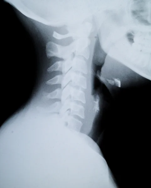 X ray neck and Jaw — Stock Photo, Image