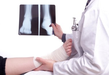 Doktor sınav bir x-ışını fotoğrafı burkulan ayak