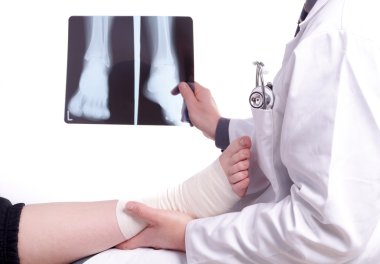 Doctor exam one X-ray picture of sprained foot clipart