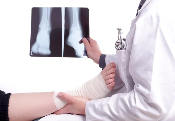 Arzt untersucht ein Röntgenbild des verstauchten Fußes Stockfoto
