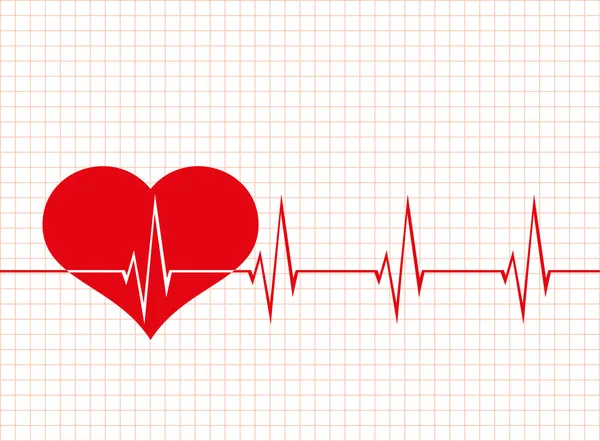 Schema elettrocardiografico — Vettoriale Stock