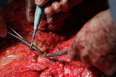 Gemi yakın çekim dağlamak