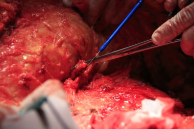 Yakın çekim doldurarak