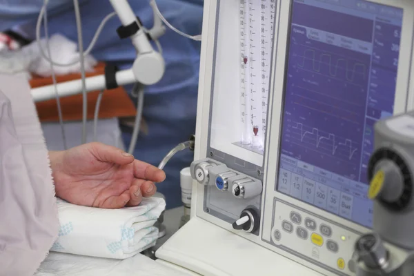 Anesthesia machine in usage — Stock Photo, Image