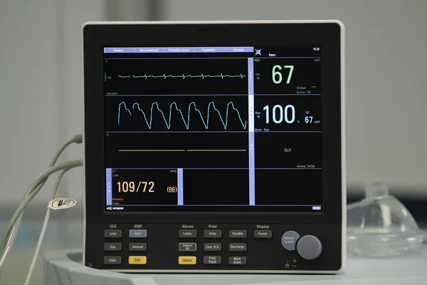 EKG monitör
