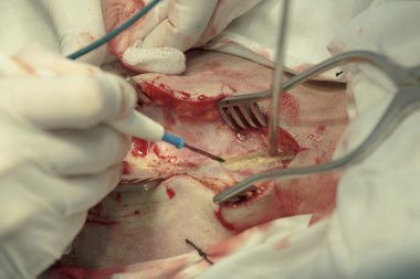 Cephalotrypesis