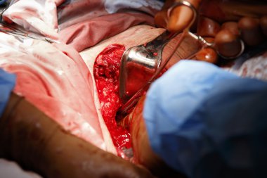 Cerrah'ın parmak yara içinde