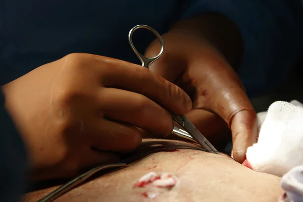 Surgeon's hands — Stock Photo, Image