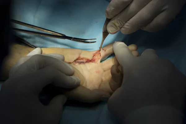 El cerrahisi araçları closeup ile